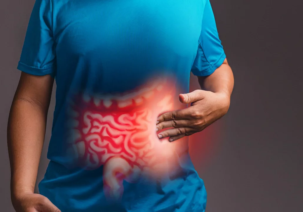 Acotiamide: A Possible Solution for Chronic Indigestion