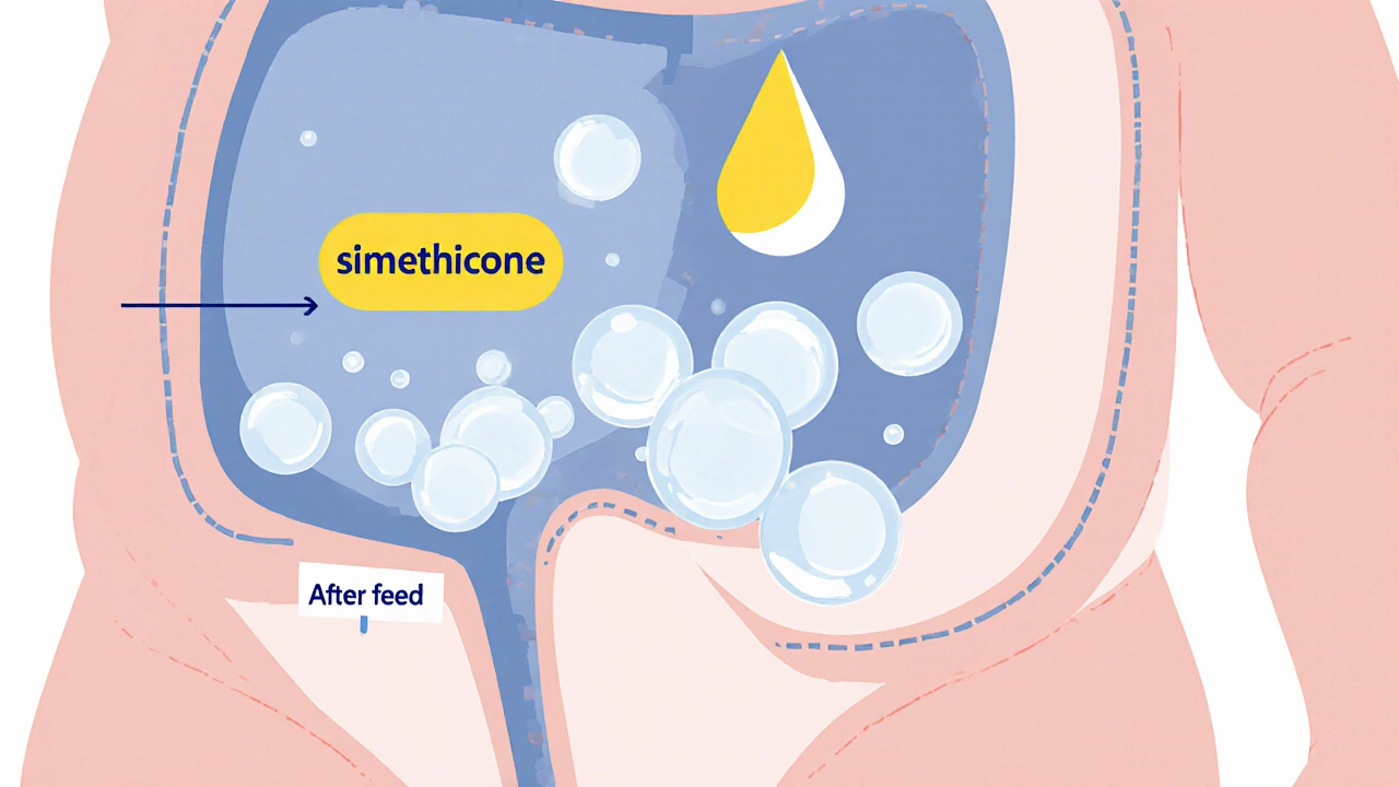 Cross‑section showing simethicone merging gas bubbles in a baby's stomach.